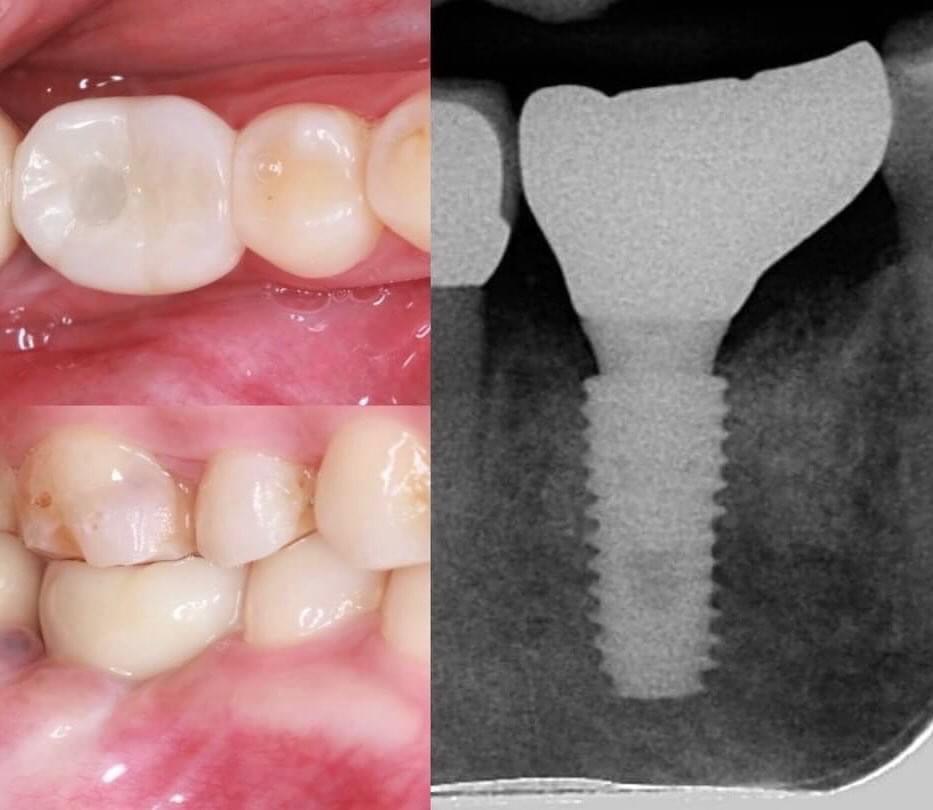 S__128712732