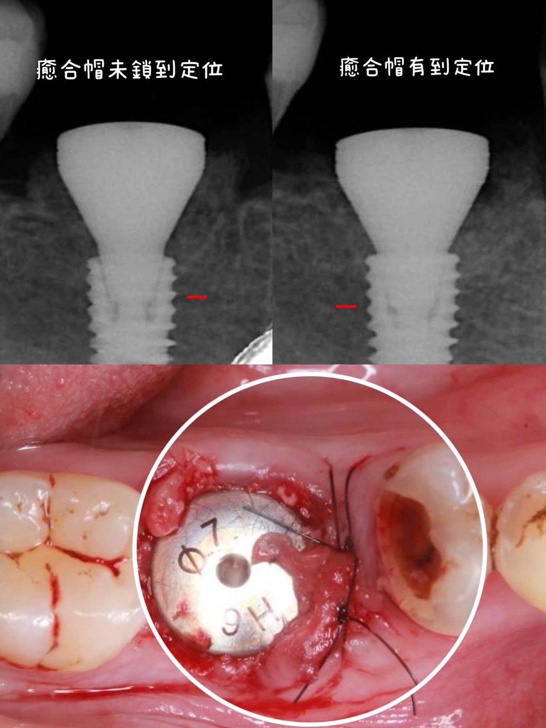 S__136847376