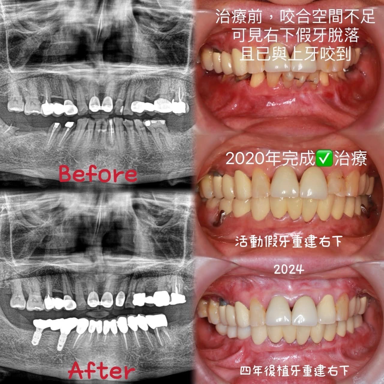 messageImage_1747208866490