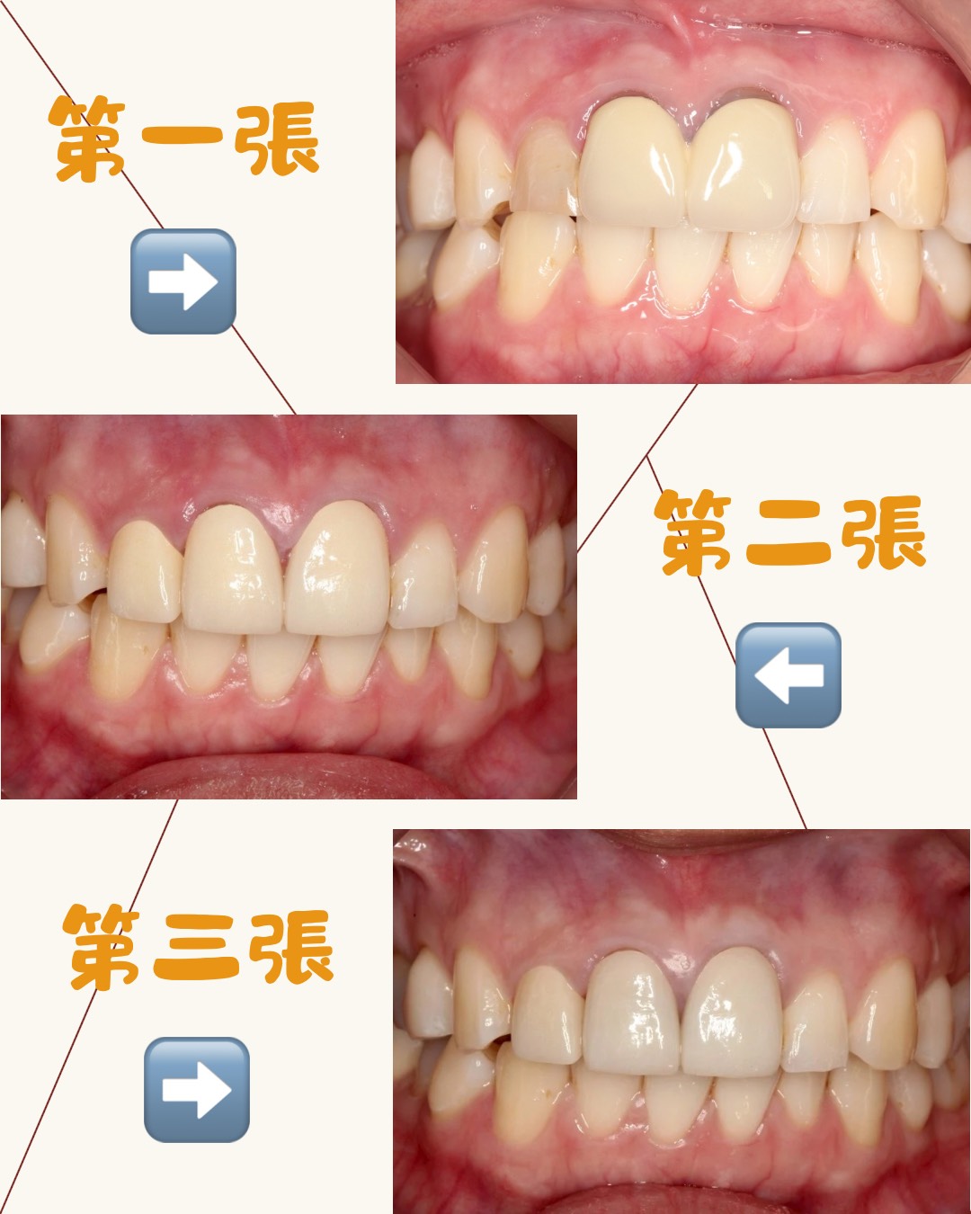 門面的重要