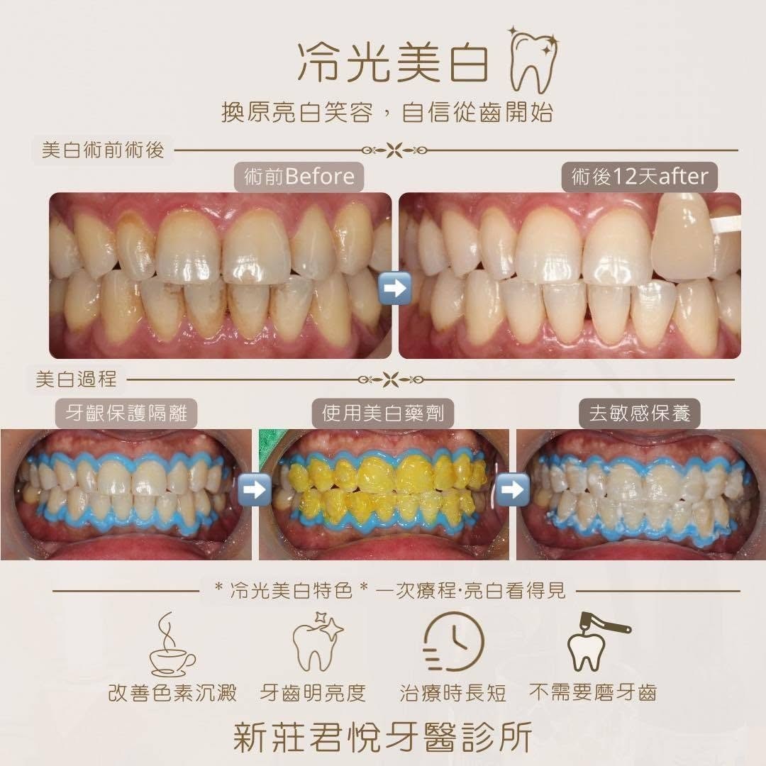 今天來聊聊H先生的美白案例