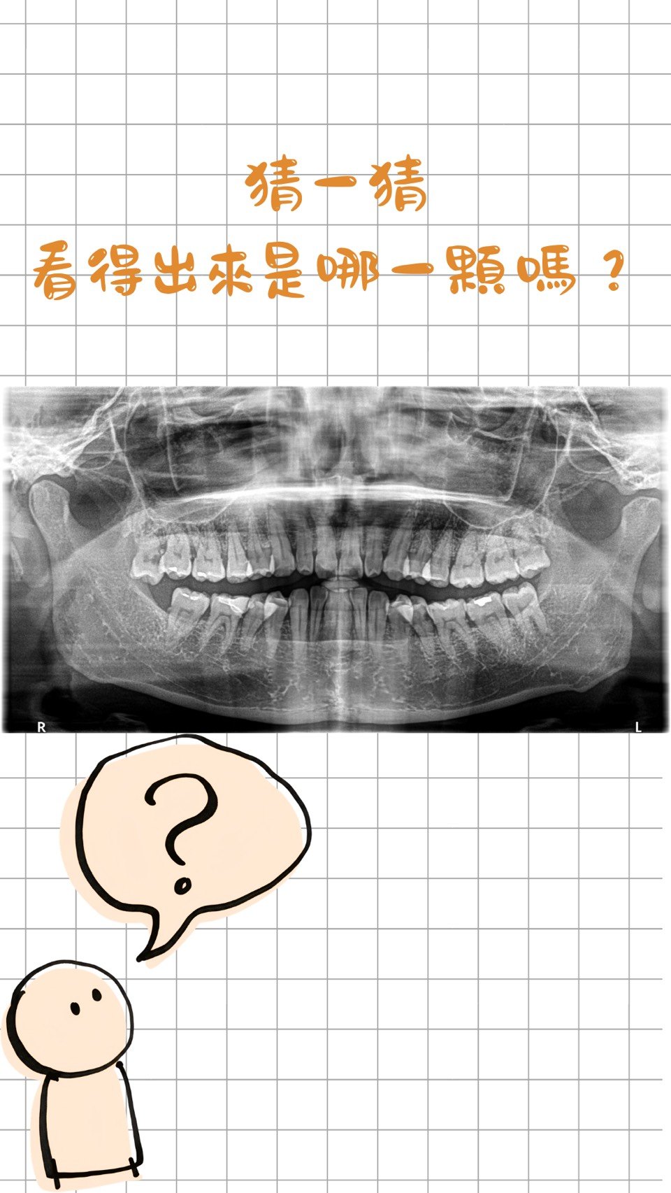 你有看過「會跳舞的牙齒」嗎？