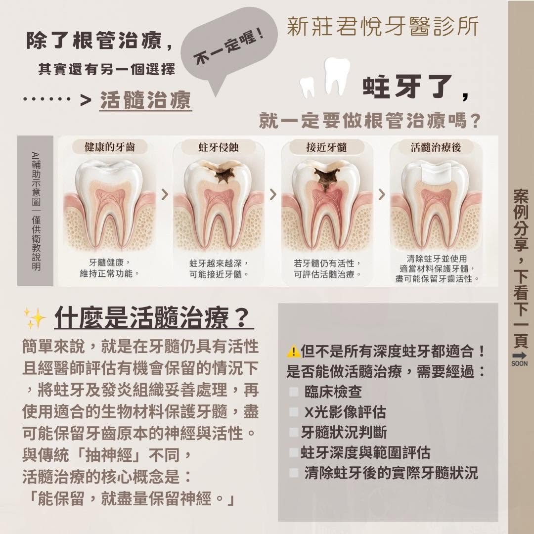 蛀牙了,就一定要做根管治療嗎?